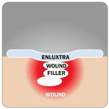 How To Use the Enluxtra Dressing